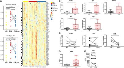 The Type I Interferon Pathway Is Upregulated in the Cutaneous Lesions and Blood of Multibacillary Leprosy Patients With Erythema Nodosum Leprosum